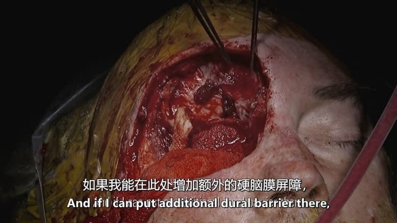 BBC纪录片《外科医生：生命边缘 Surgeons: At the Edge of Life 2024-2025》第6-7季全12集 英语中英双字 官方纯净版 1080P/MKV/38.4G 手术室的故事插图4