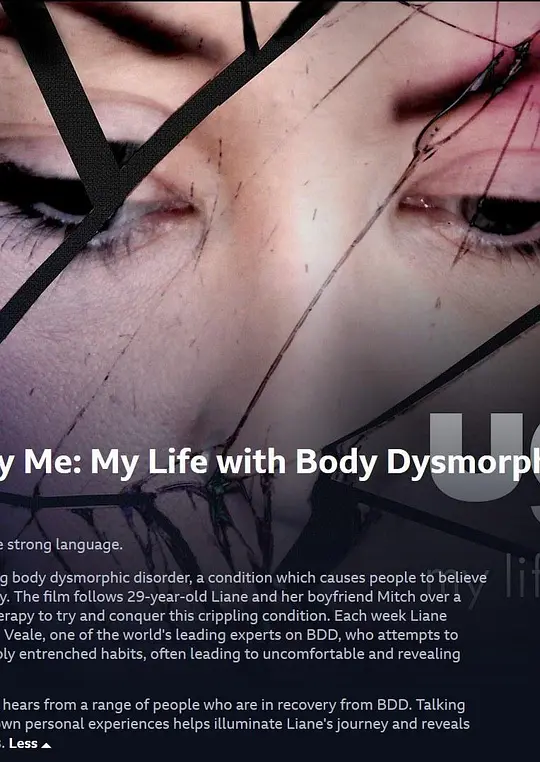 BBC纪录片《丑陋的我:身体畸形恐惧症 Ugly Me: My Life with Body Dismorphia 2018》英语中英双字 无水印纯净版 1080P/MKV/1.73G 身体缺陷插图 BBC纪录片《丑陋的我:身体畸形恐惧症 Ugly Me: My Life with Body Dismorphia 2018》英语中英双字 无水印纯净版 1080P/MKV/1.73G 身体缺陷插图