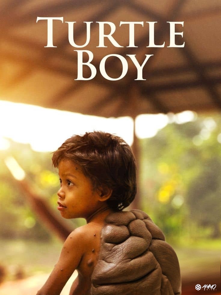 英国纪录片《海龟男孩 Turtle Boy 2023》英语中英双字 无水印纯净版 1080P/MKV/1.92G 罕见疾病插图