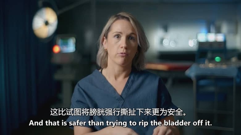 BBC纪录片《外科医生：生命边缘 Surgeons: At the Edge of Life 2024-2025》第6-7季全12集 英语中英双字 官方纯净版 1080P/MKV/38.4G 手术室的故事插图5