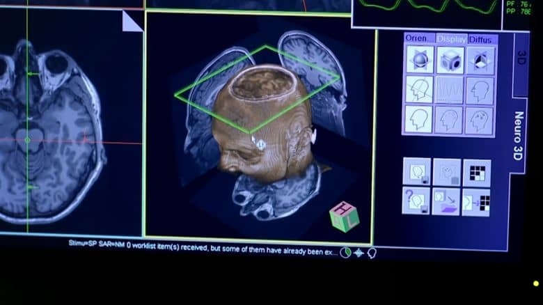 英国纪录片《令人痴迷的色情 Porn on the Brain 2013》英语无字 无水印纯净版 1080P/MKV/2.04G 色情的危害插图2