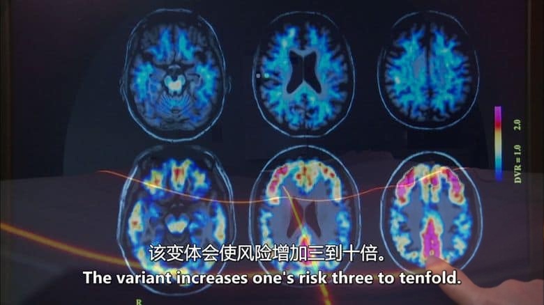 PBS纪录片《破解您的遗传密码 Cracking Your Genetic Code 2012》英语中英双字 无水印纯净版 1080P/MKV/3.02G 基因医学插图4 PBS纪录片《破解您的遗传密码 Cracking Your Genetic Code 2012》英语中英双字 无水印纯净版 1080P/MKV/3.02G 基因医学插图4