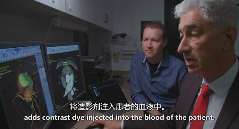 美国纪录片《胆固醇密码 The Cholesterol Code 2026》英语中英双字 无水印纯净版 食品健康纪录片插图4 美国纪录片《胆固醇密码 The Cholesterol Code 2026》英语中英双字 无水印纯净版 食品健康纪录片插图4