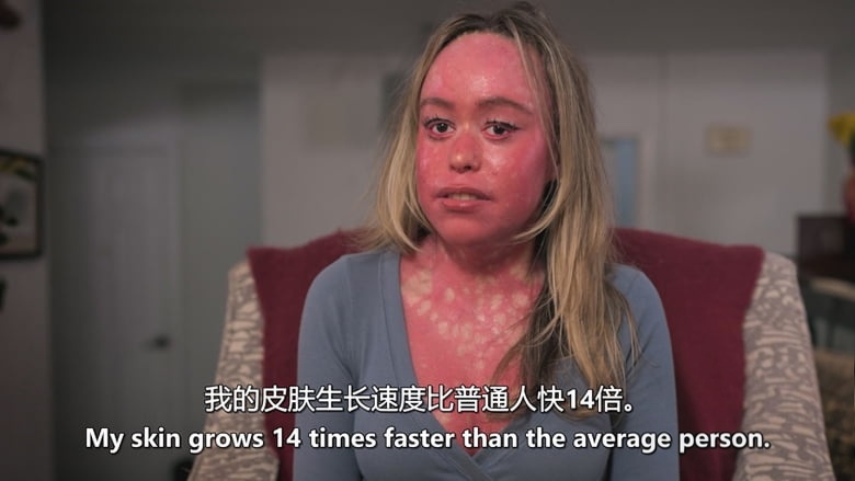 TLC纪录片《我身体的一天 One Day in My Body 2026》第一季全8集 英语中英双字 无水印纯净版 全球罕见疾病插图1 TLC纪录片《我身体的一天 One Day in My Body 2026》第一季全8集 英语中英双字 无水印纯净版 全球罕见疾病插图1