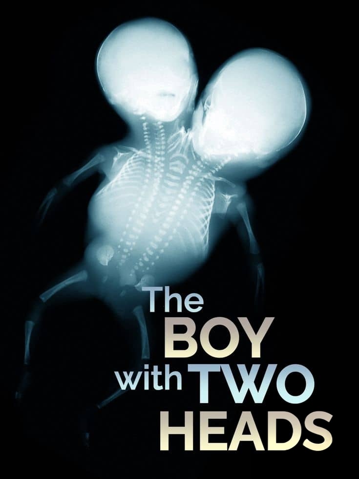 美国纪录片《双头男孩 The Boy with Two Heads 2014》英语中英双字 无水印纯净版插图