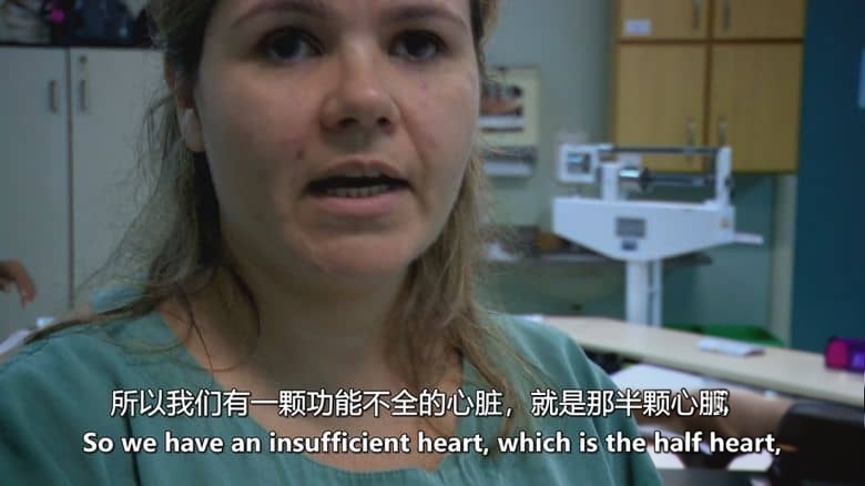 美国纪录片《双头男孩 The Boy with Two Heads 2014》英语中英双字 无水印纯净版插图2